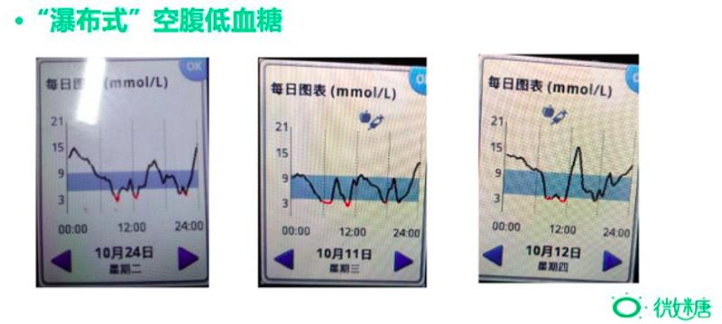 空腹运动低血糖正常吗,半夜低血糖吃了糖算不算空腹