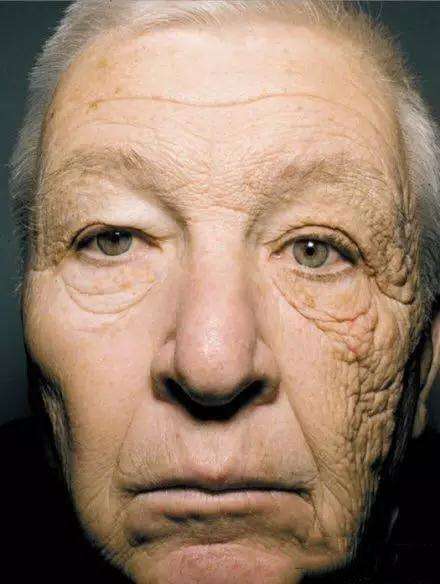 涂了防晒还是黑,有人坚持天天涂防晒吗