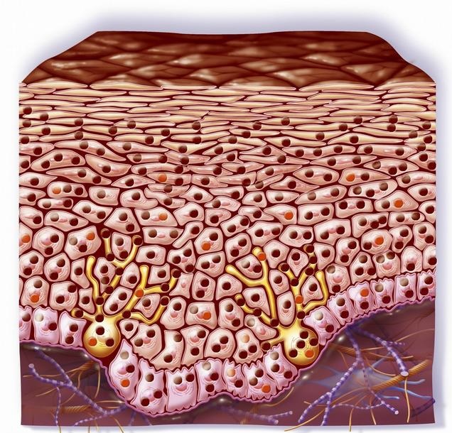 脸上长了褐斑是什么原因,脸上起褐斑怎么治疗最好