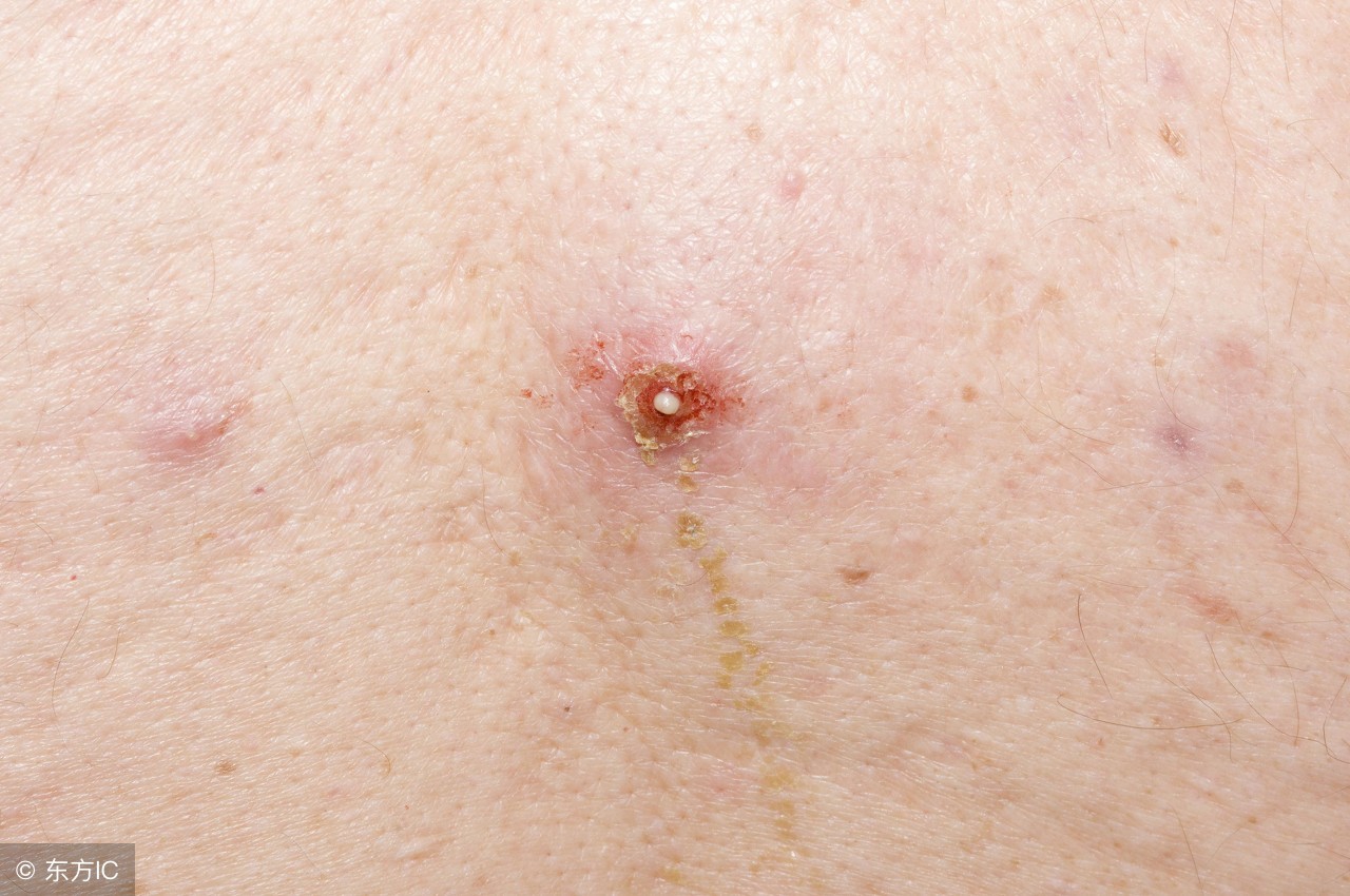 风油精隐藏的六大小常识,小常识风油精