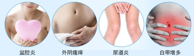 100万日本女性免受妇科病困扰的标配，就是Ta~