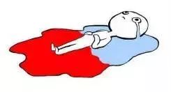 100万日本女性免受妇科病困扰的标配，就是Ta~