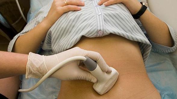 产后42天复查太麻烦不想去?这两项检查可不能偷懒,查查才放心