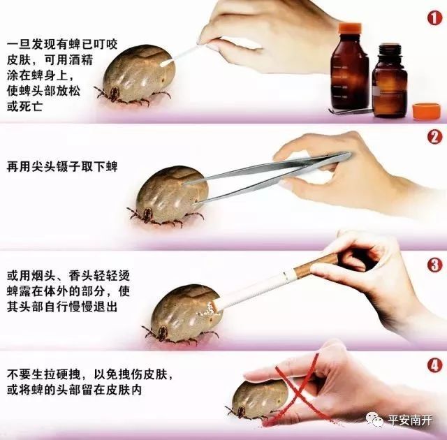 津城现疑似蜱虫叮咬病例？专家来解读！「平安警务室」