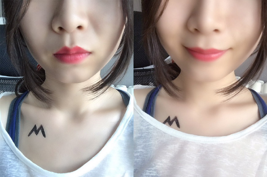 眼角纹法令纹和笑纹该怎么去除,怎么去除笑纹抬头纹法令纹