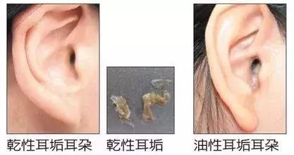 4种方法自测一下你有没有腋臭,腋臭最新解决方法