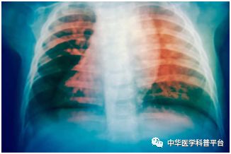 盗汗的原因男士,小孩盗汗什么原因