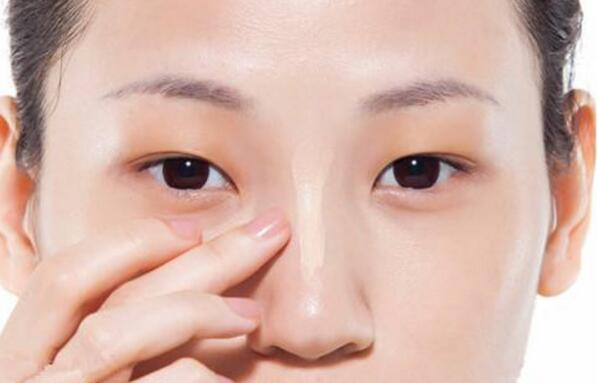 鼻子黑头小颗粒怎么去除,鼻子反复长黑头挤完都是坑