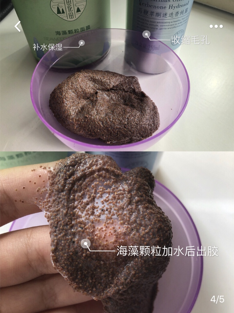 脸上出油多堵塞毛孔粗大白醋洗脸,混油皮收缩毛孔小妙招
