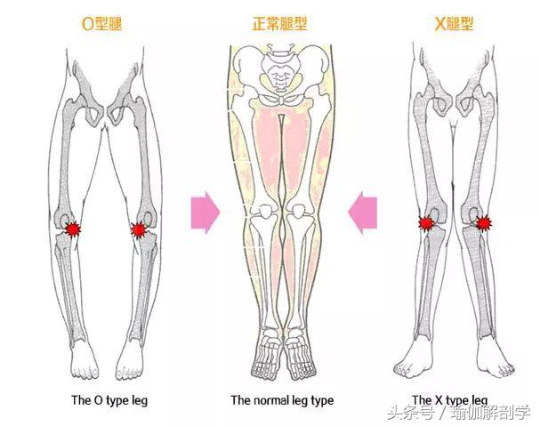 平时膝盖疼怎么回事,平时膝盖酸痛怎么缓解
