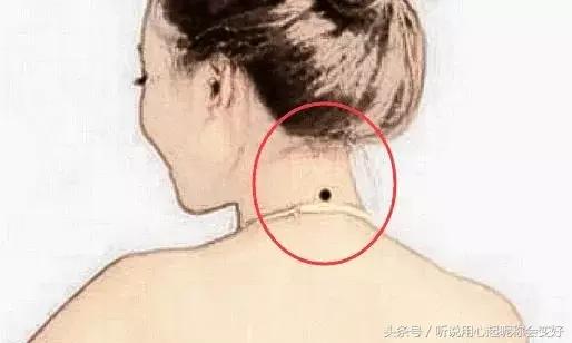 人中好痣和恶痣的图,人有恶痣
