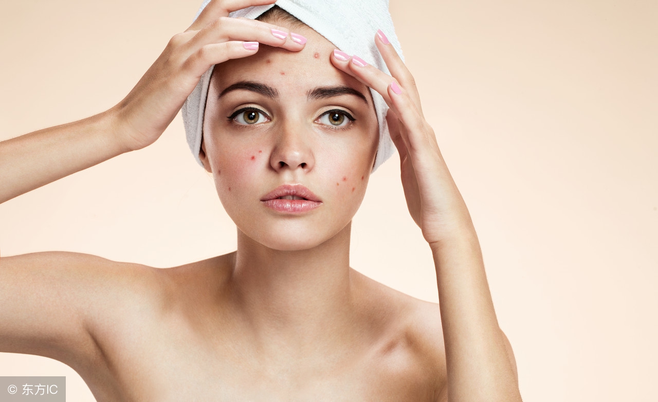 温和有效的去粉刺小窍门,7天改善闭口粉刺细腻光滑肌肤