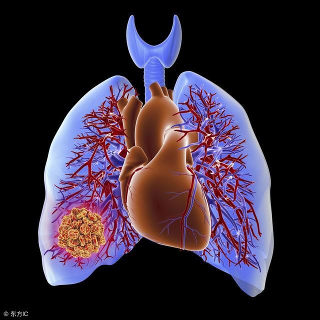 心脏早搏怎么办如何缓解,发现心脏早搏