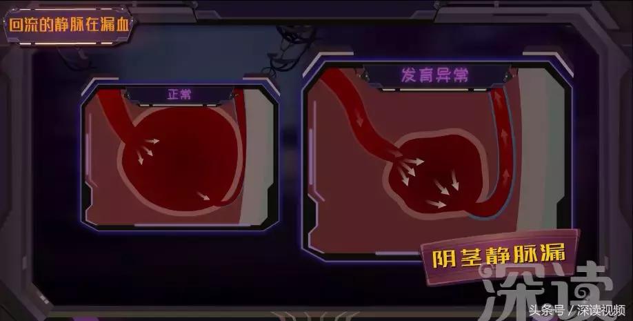 谁让你“兄弟”不给力，谁让你“痿”靡不振？阳痿诱发因素知多少