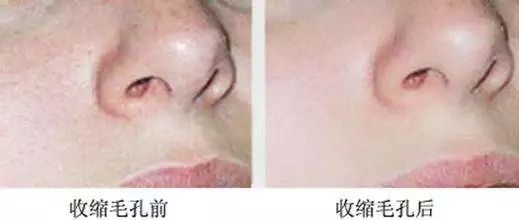 十大最坑爹护肤谣言视频,别再让这些谣言满天飞了