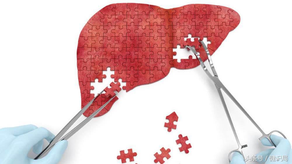 丙肝患者的克星,2023治愈丙肝多少钱