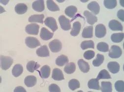 全城“通缉”的锥蝽有什么“罪”？让我们来告诉你！