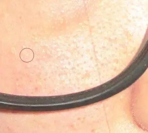 皮肤检测仪从三个层次分析,皮肤检测仪帮你判断皮肤问题