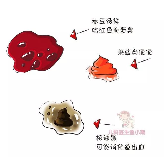 宝宝便便看出健康大问题,宝宝便便形状代表各种情况