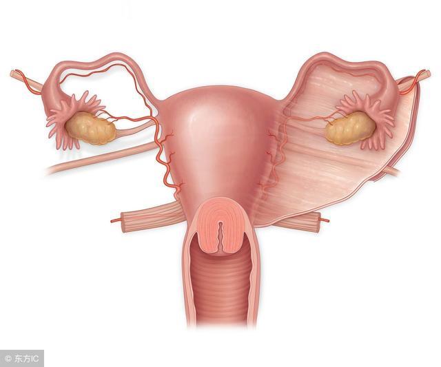 宫颈息肉有原因，这三个检查项目需要做