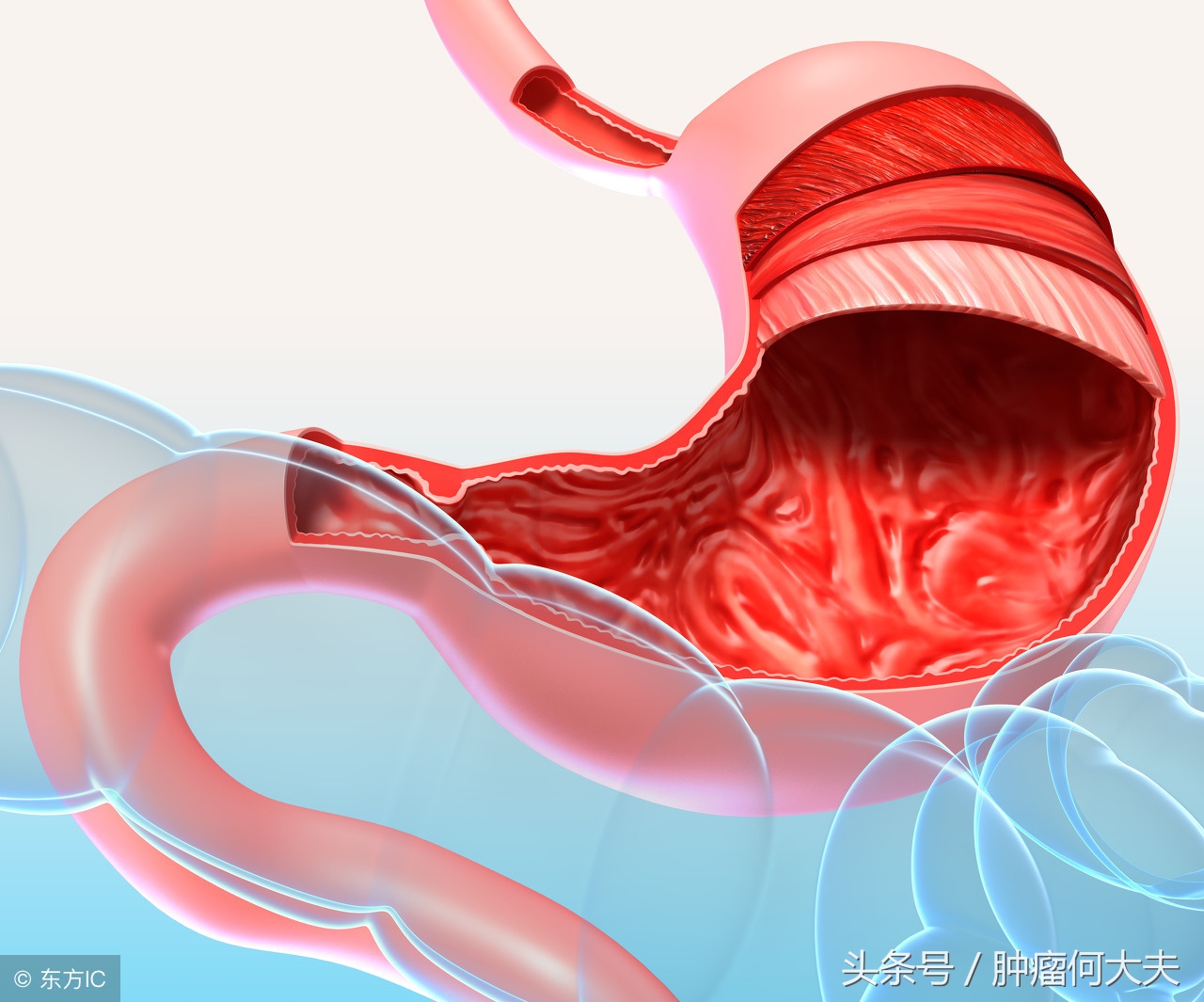 怀孕后总怀疑自己得了胃癌,孕期确诊胃癌的方法有哪些