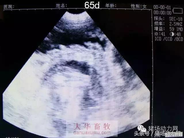 母猪b超图像如何看,怀孕100天的母猪b超影像