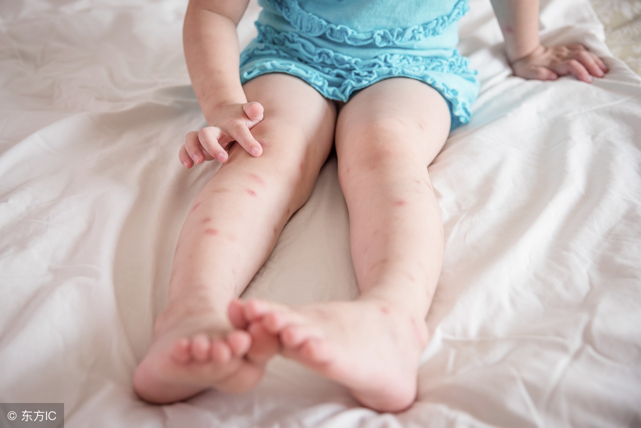 婴儿夏季防虫,夏天宝宝防叮咬