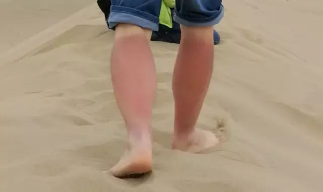 夏日旅游防晒必备推荐,暑假旅游防晒必备物品有哪些