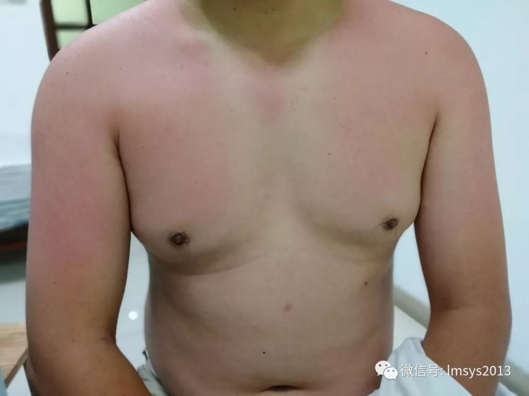 夏日旅游防晒必备推荐,暑假出游记防晒不可少