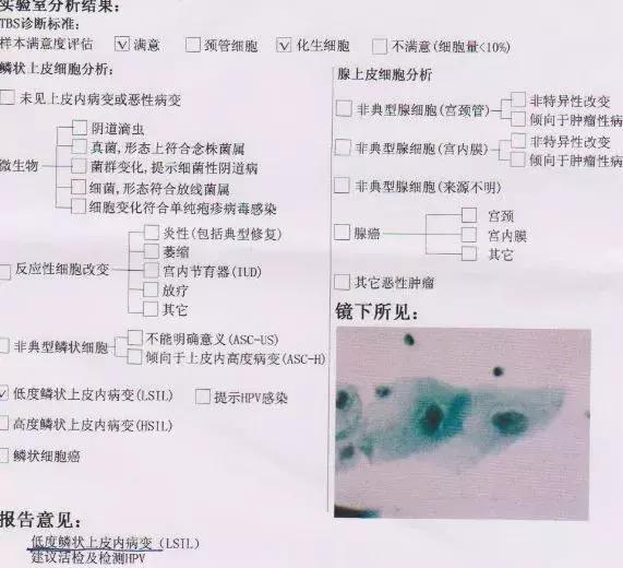宫颈癌10大高危人群是哪些？带你了解宫颈癌筛查的方方面面！