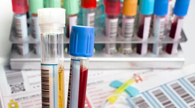 健康体检前要注意哪些事项,健康体检注意事项