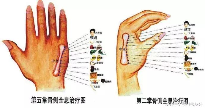 针灸按摩全息图（收藏版）
