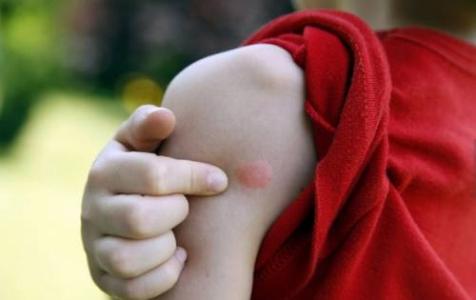 宝宝能不能用风油精？很多宝妈用错，导致婴儿进医院