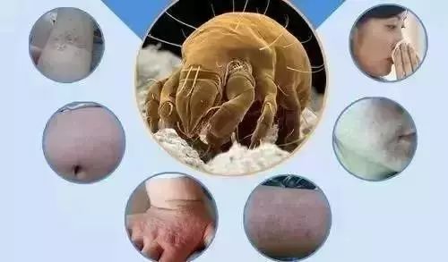 被子床单多长时间换一次避免螨虫,床单睡衣多久换一次