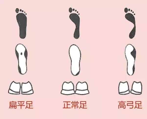 鞋底偏了哪里有问题,左脚鞋底外侧磨得厉害怎么矫正