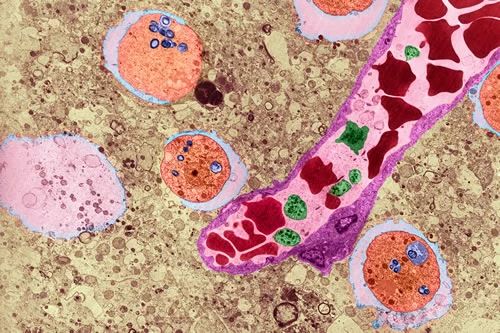 感染食脑虫的人,感染食脑虫的动物