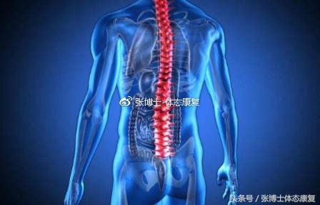 运动康复科普强直性脊柱炎,强直性脊柱炎腰部锻炼康复方法