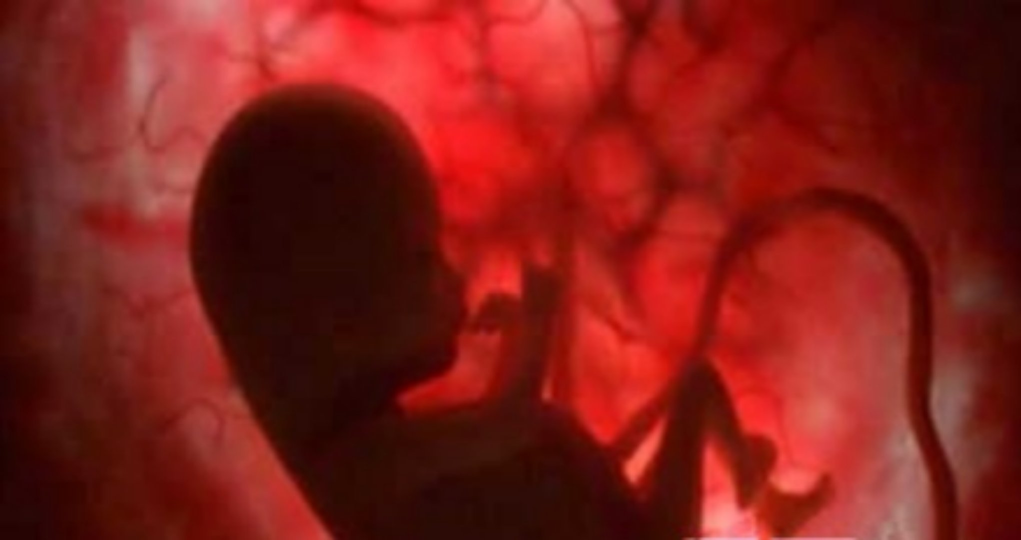 孕期B超，你做对时间了吗？