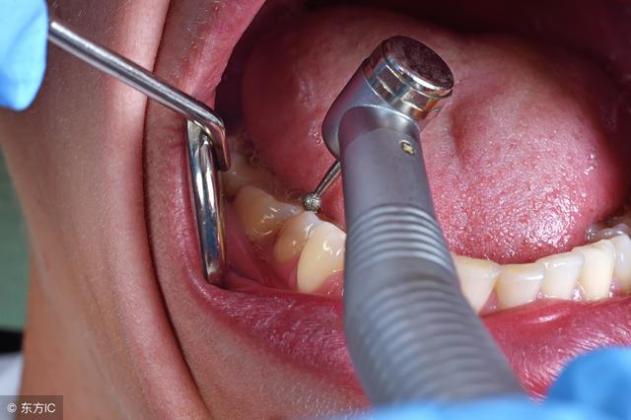 长了智齿怎么办,智齿横着长怎么办