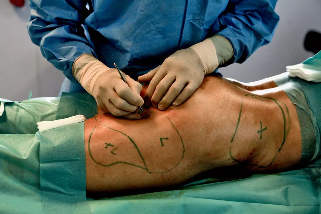 世上最贵的肉，永远是即将减掉的那一斤｜CBNweekly封面故事