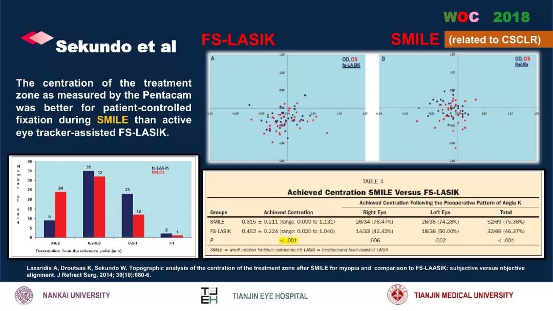 散光治疗技术突破,散光的矫正