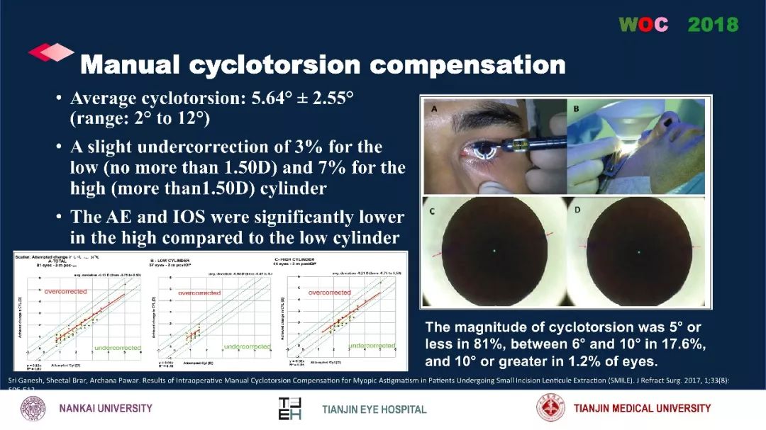 散光治疗技术突破,散光的矫正