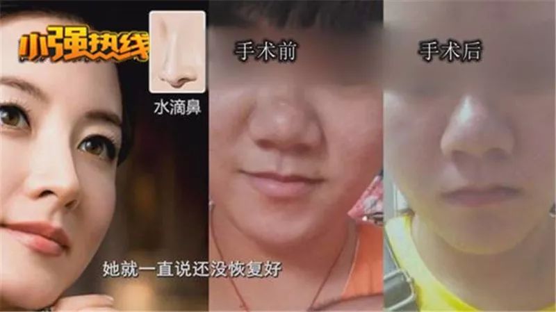 花三千整鼻子,花三万整的鼻子值不值