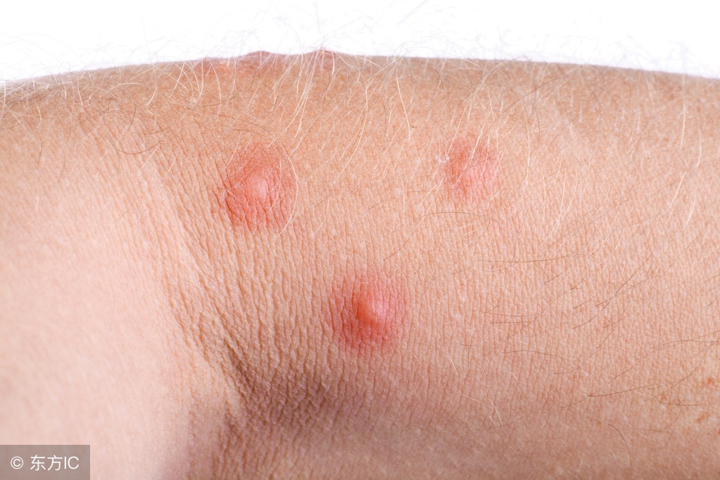 儿童床垫不易长螨虫,10年床垫螨虫