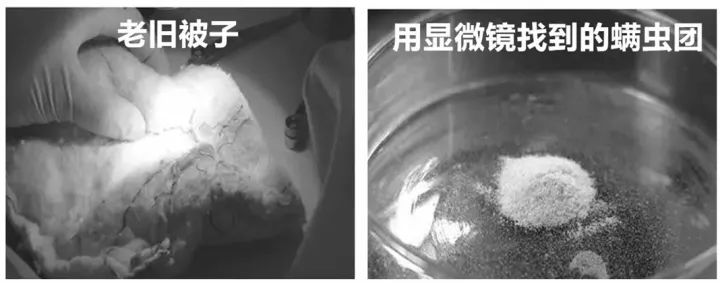 螨虫走开！中疾控检测100%有效，家有小宝、消除过敏源必备