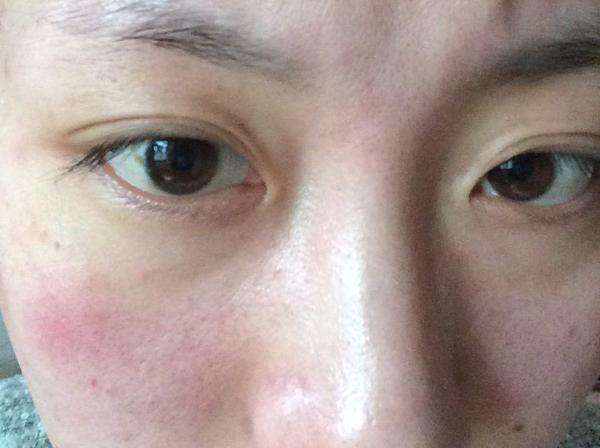 女性身体出现问题的10个征兆,女人身上出现5种异常