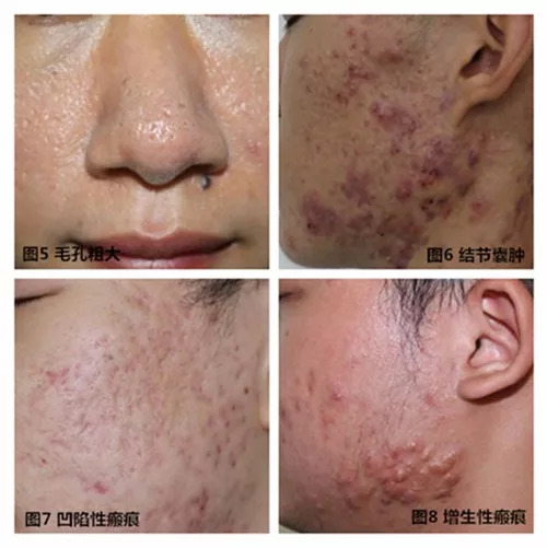 东部战区空军医院义诊,空军总医院元旦出诊安排