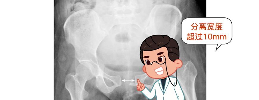 生了孩子怎么改善胯宽,生过孩子胯宽屁股大怎么办