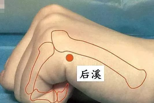 颈椎病的治疗方法和技巧,颈椎病的治疗最佳方法有哪些