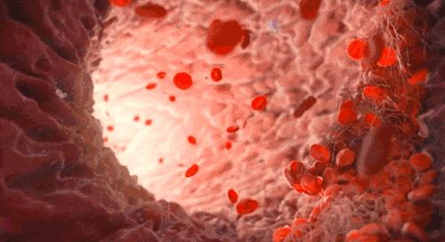 贫血会有三大征兆吗,贫血严重了能引起什么并发症